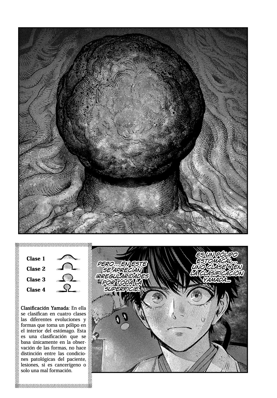 Koudou ni Hattatsu Shita Igaku wa Mahou to Kubetsu ga Tsukanai Capitulo 8: EMR = Tratamiento endoscópico página 19